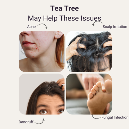 Tea Tree Pure Essential Oil