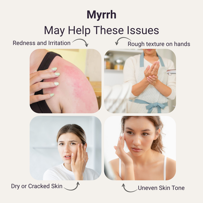 Myrrh Pure Essential Oil